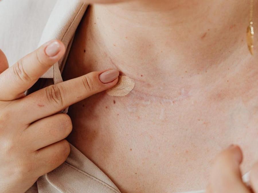 Ask Dr. Jean: Scar solutions