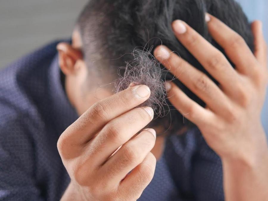 Ask Dr. Jean: Why Has My Hair Started Falling Off Since The Pandemic Started?