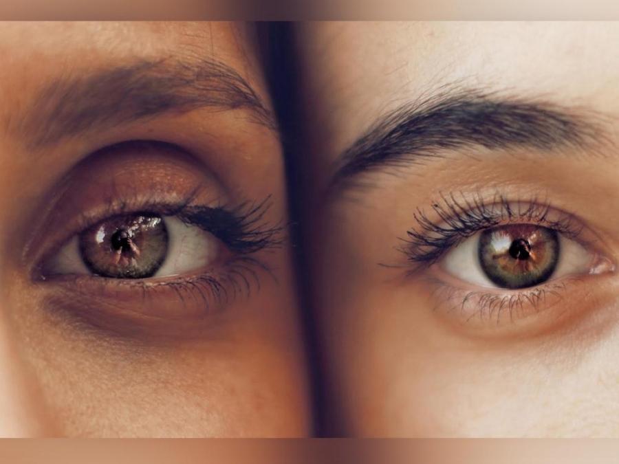Ask Dr. Jean: How to prevent having 'panda eyes'