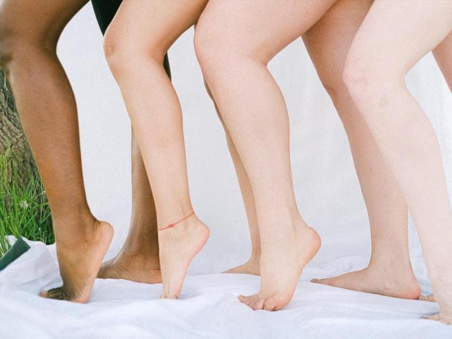 Banish varicose veins for lovely legs this summer